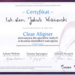 Clear Aligner
